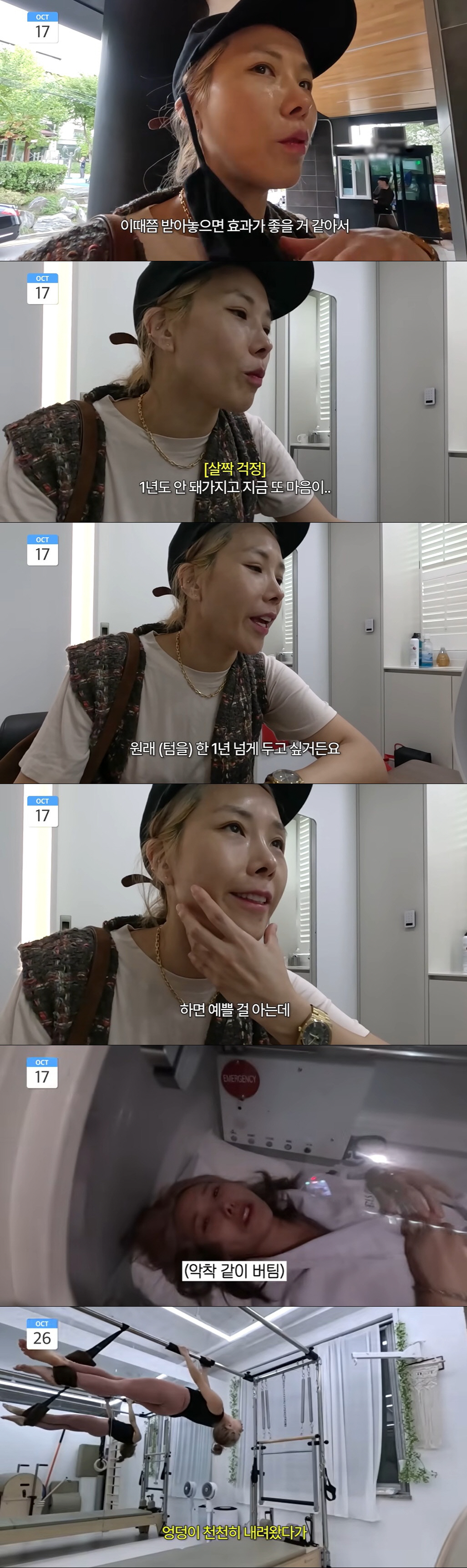 신봉선, 체지방만 11kg 감량하더니 '시술 중독' 고민 "너무 자주할까…