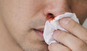 한 쪽 코에서 코피 자주 나고 코막힘 반복, 암일 수 있다?