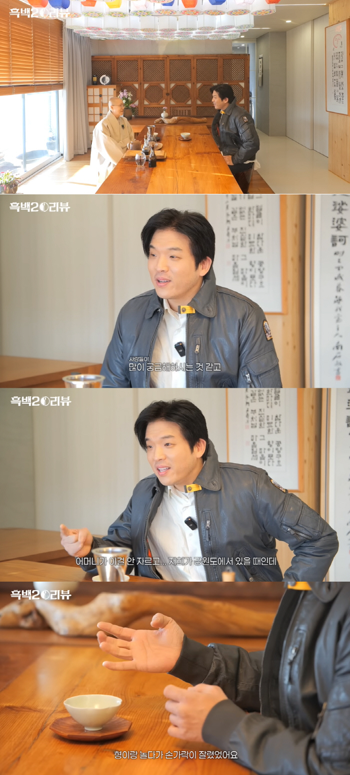 안성재, 굽혀 펴지지 않는 손가락..“사고로 잘려서 다시 붙여”