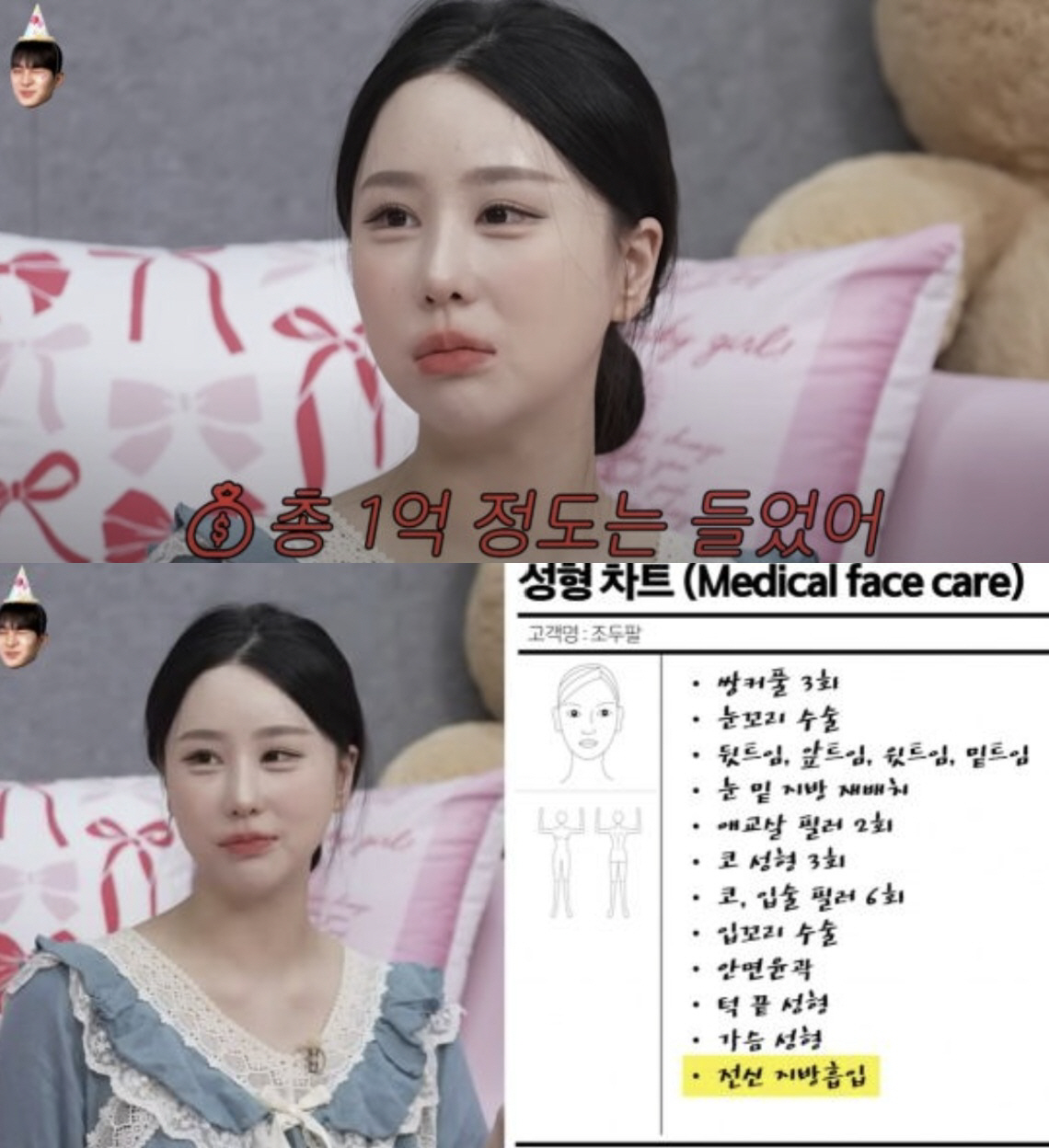 '성형비 1억' 조두팔, 필러 맞고 '직각 어깨' 완성 "없던 어깨가 생…