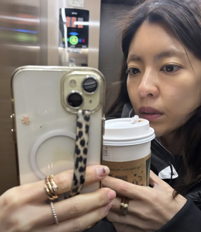 이윤지, 겨울철 계단서 낙상사고 '콰당'...안타까운 '손톱 멍·베인 상처'