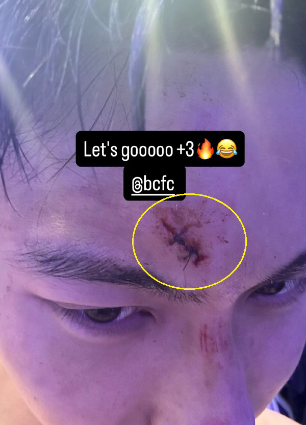 [오피셜]"한-일 자존심 걸렸다" 버밍엄 백승호 VS 리즈 다나카, FA…