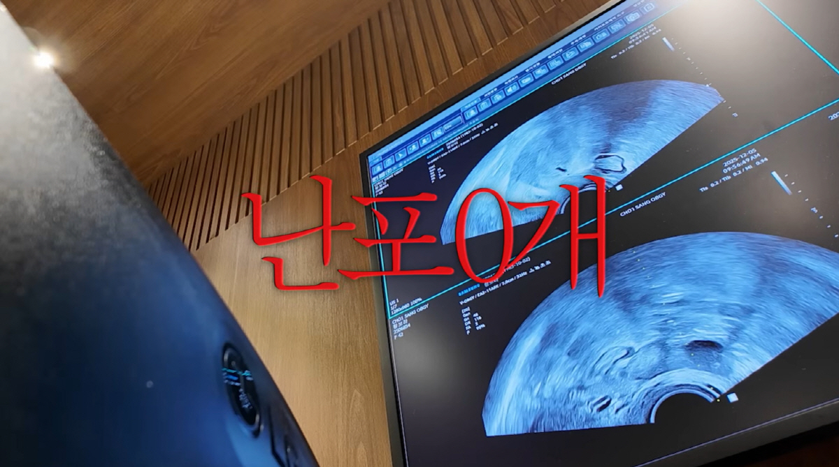 '42세' 황보라, 둘째 시험관 중 "조기폐경 수치" 결과에 '충격' (…