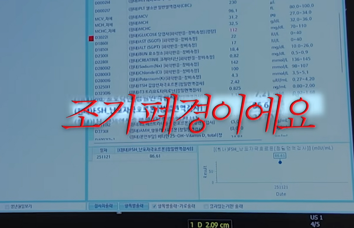 황보라 "임신확률 0.01%에도 태어난 첫째…둘째는 더 난관→조기 폐경 …