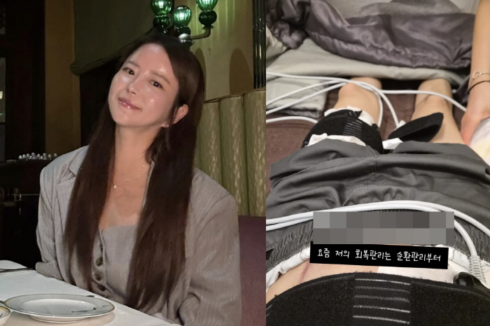 '이수근♥' 박지연, 신장 이식 수술 자국이 선명…"수술 후 물부터 바꿔"