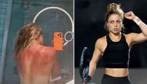 여성 테니스 스타, 속살 셀카 공개 …빨갛게 변한 이유 '충격'