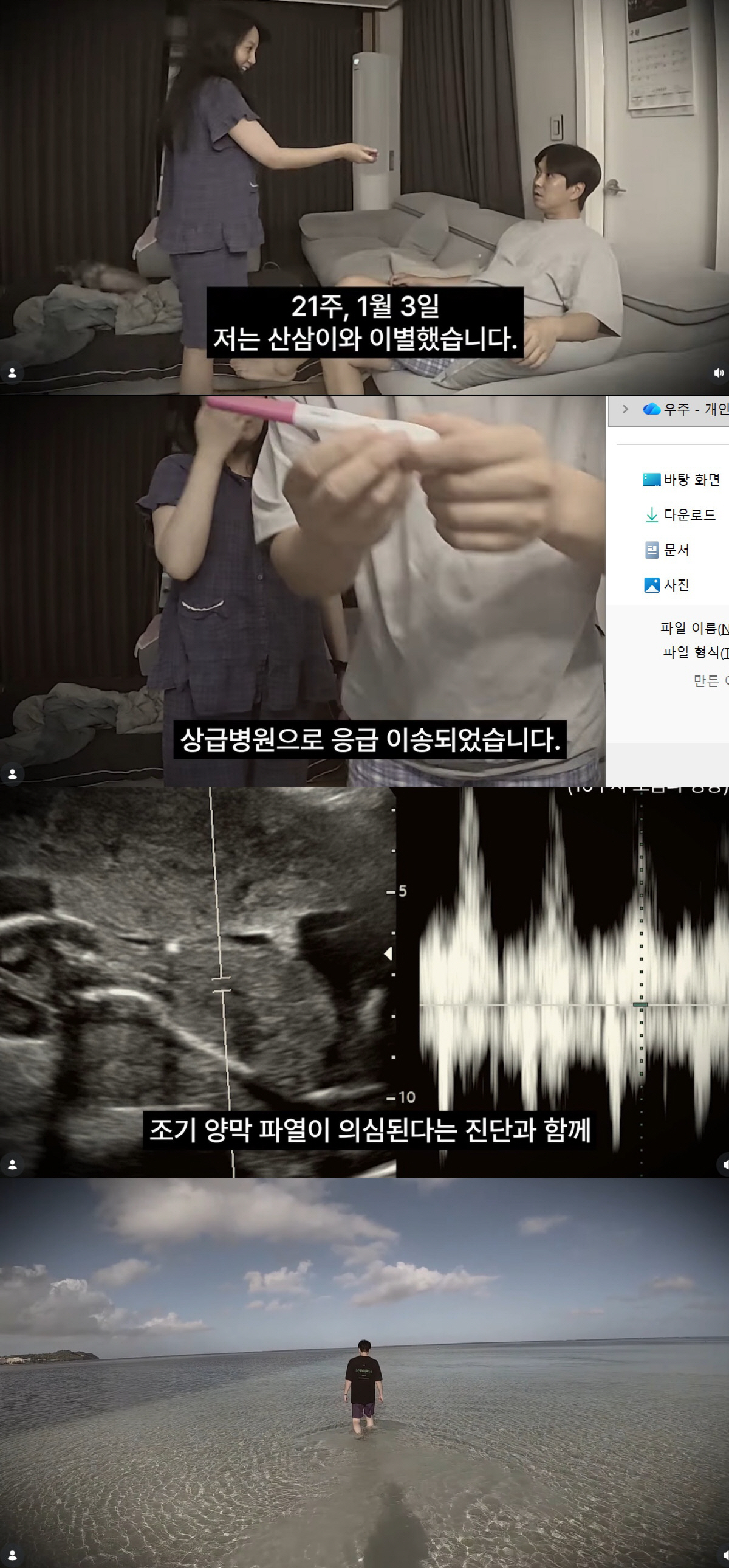 강은비, 뱃속 아이 떠나 보내고 오열 "태어나자마자 떠나, 장례도 직접"