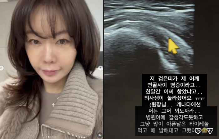 '캐나다 이주' 안선영, 결국 병원행..회전근개 파열·염증 "의사도 놀라…