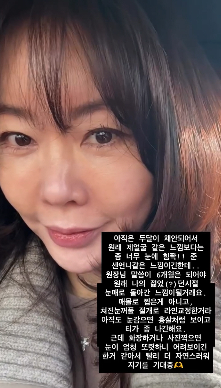 '50세' 안선영, 쌍꺼풀 수술 전·후 확 달라진 얼굴..."이제 돌아갈…