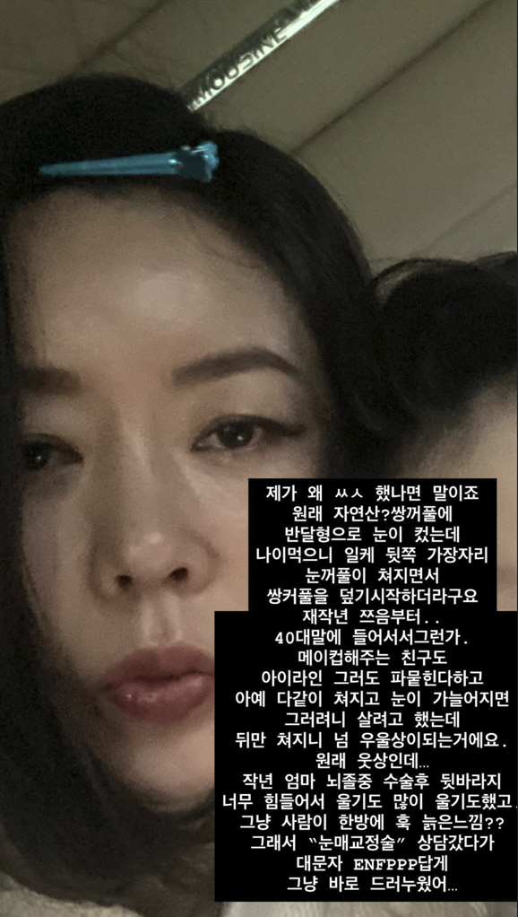 '50세' 안선영, 쌍꺼풀 수술 전·후 확 달라진 얼굴..."이제 돌아갈…