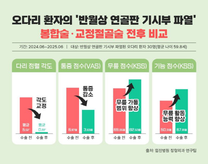 반월상 연골판 기시부 파열된 오다리…힘찬병원 "봉합술·절골술 병행치료 효…