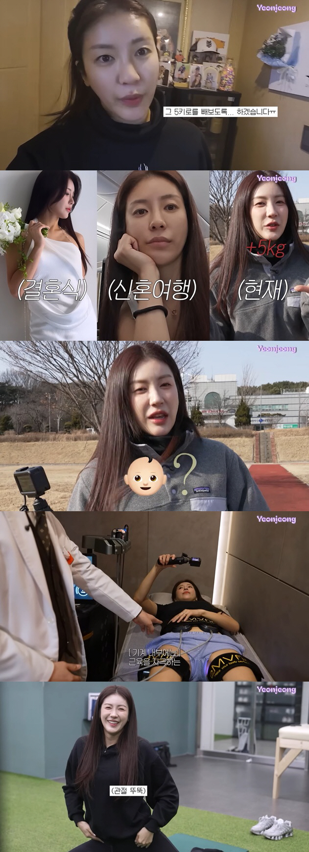 '하주석♥' 김연정, 5kg 훅 쪄 임신 오해까지 "복귀 불가 배, 내장…