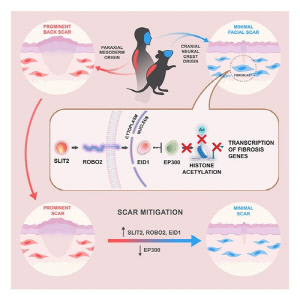 [이지 사이언스] 왜 얼굴 상처는 다른 부위 상처보다 흉터가 덜 남을까