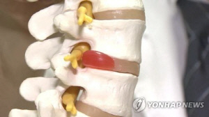 목 디스크 수술 후 엑스레이 안 보고 퇴근…환자는 사망