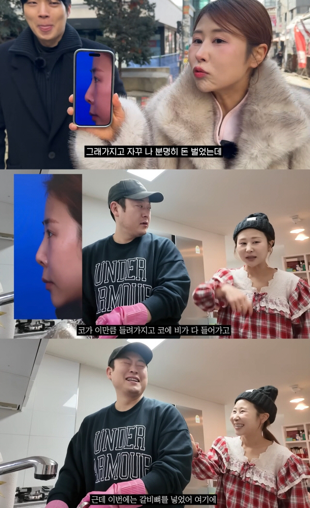 '서준맘' 박세미, 코 재수술 후 달라진 외모 "성형 부작용 구축 생겨.…