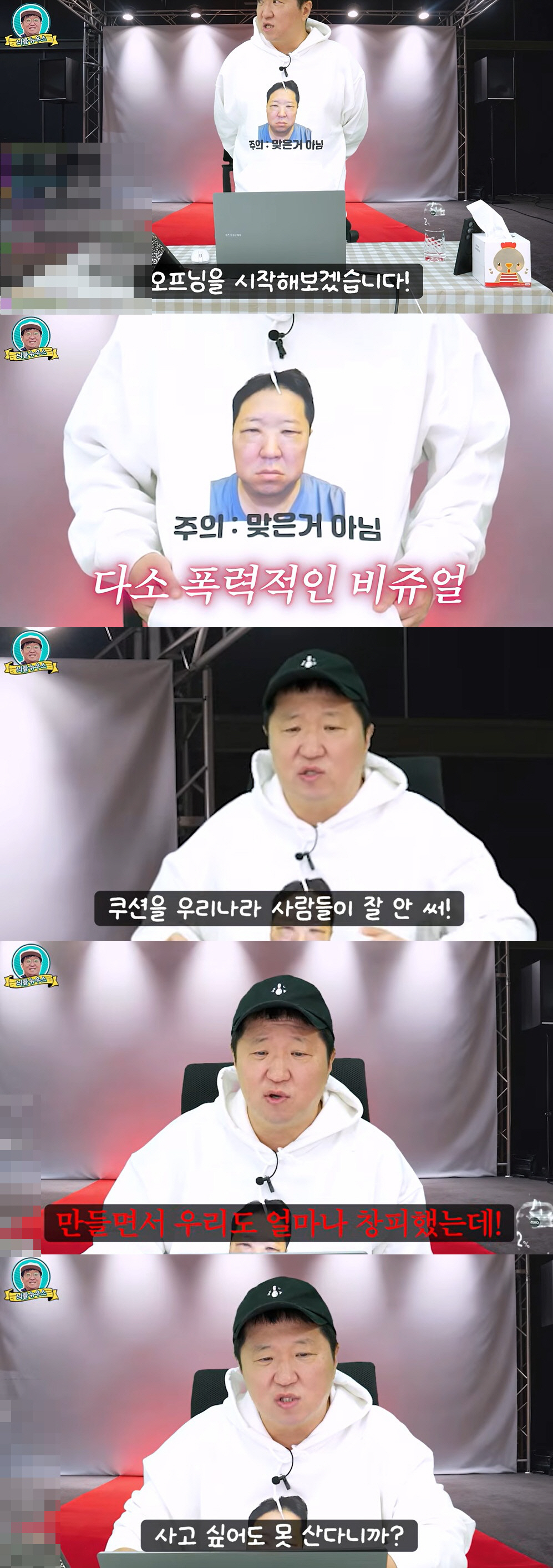 정형돈, 성형으로 퉁퉁 부은 눈…굿즈까지 완판 "사고 싶어도 못 사"