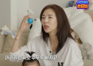 '43세' 손담비, 심각한 탈모 