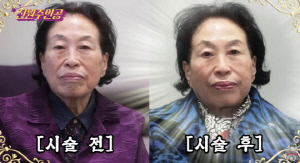 전원주, 500만원 피부과 시술 후 확 달라졌다..