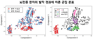 AI로 뇌전증 환자 발작 경과 5가지 유형 확인