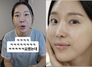 '46세' 이지혜, 인중축소술 관리로 확 달라진 동안 얼굴