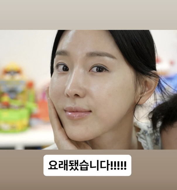 '46세' 이지혜, 인중축소술+관리로 확 달라진 동안 얼굴