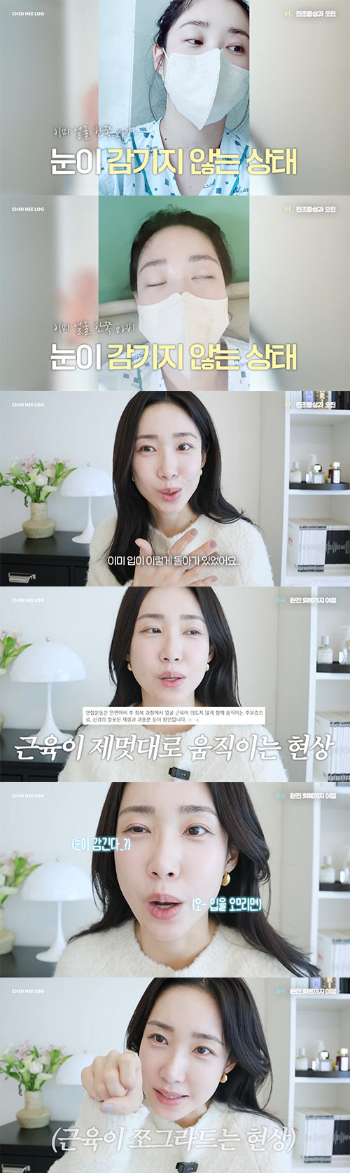 최희, '안면마비'로 미각·후각 상실..."거울 보니 입이 돌아가 있더라…