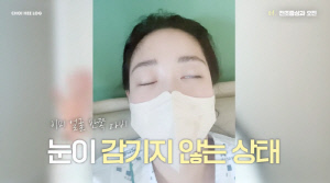 최희, '안면마비' 후 얼굴 반쪽 멈췄다...