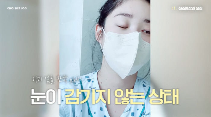 최희, '안면마비' 후 얼굴 반쪽 멈췄다..."눈 안 감겨 테이프 붙이고…