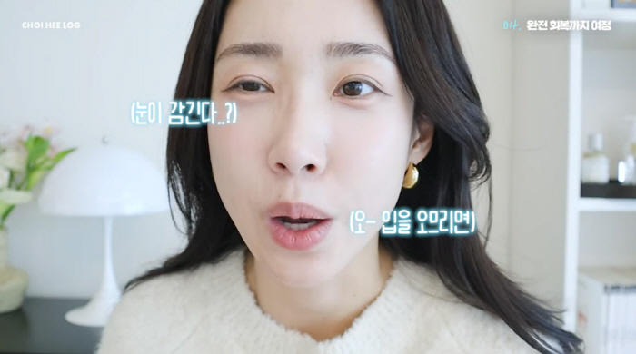 최희, '안면마비' 후 얼굴 반쪽 멈췄다..."눈 안 감겨 테이프 붙이고…