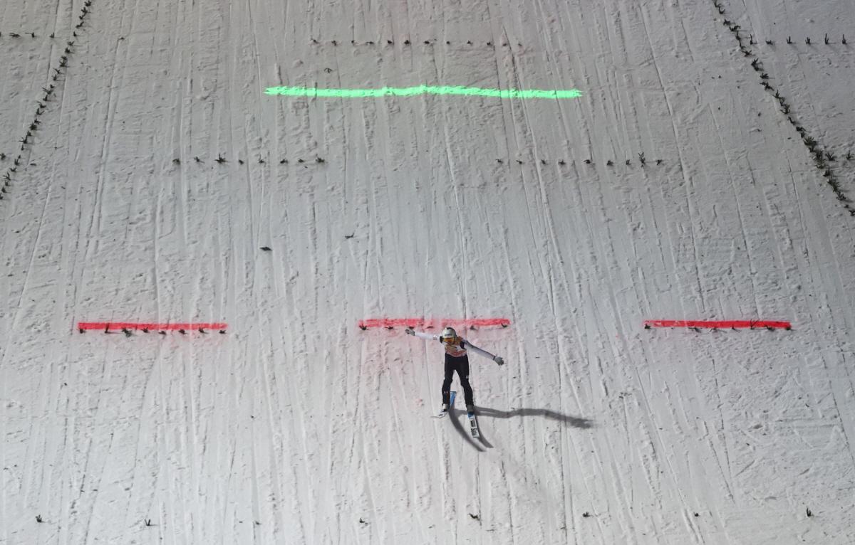 '어떻게 그곳에 주사를...' 올림픽 위해 생식기에 필러, 세계를 뒤흔든…