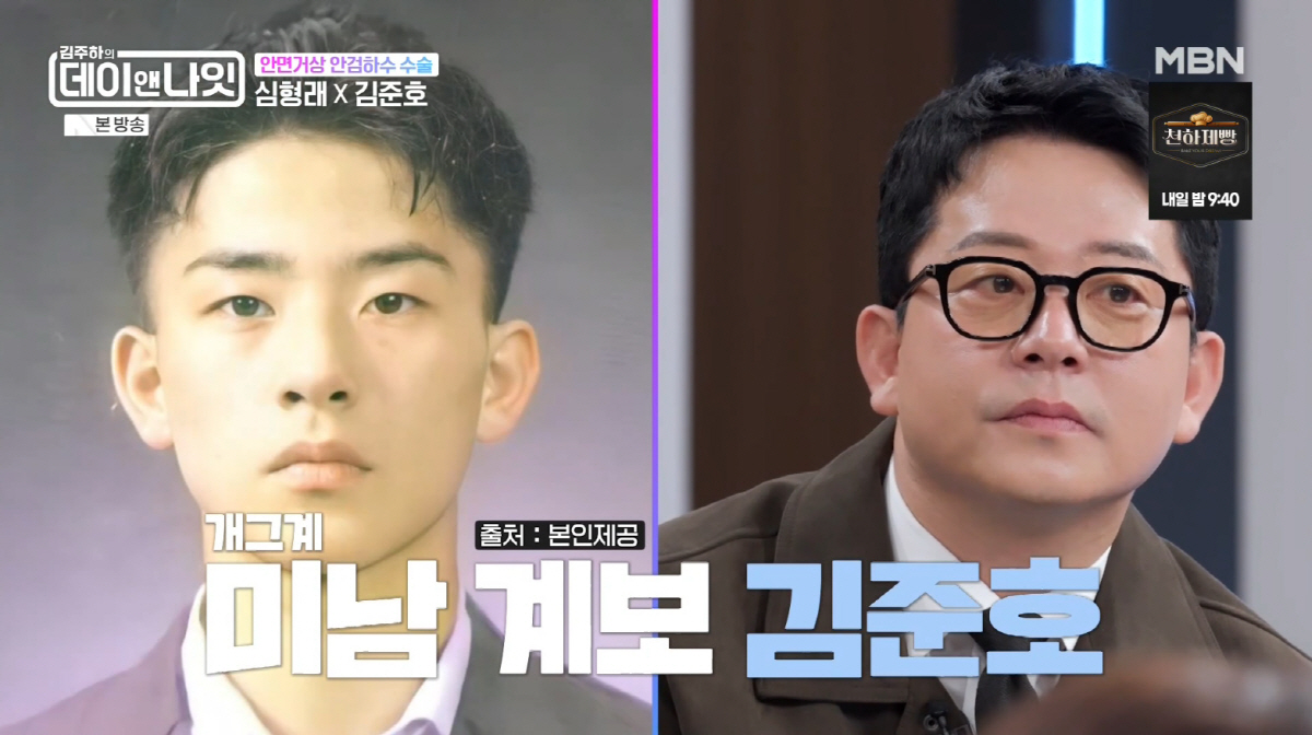 김준호, 안검하수 수술 전·후 첫 공개..."눈썹 지방제거는 10년 전에…