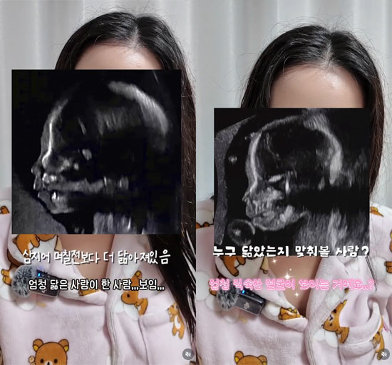 '최현석 딸' 최연수, 초음파서 할아버지가 보여…"아기가 요리 잘 할것 …