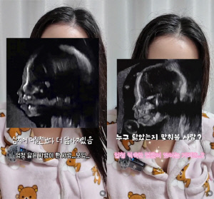 '최현석 딸' 최연수, 초음파서 할아버지가 보여…