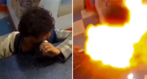 10대 소년 입에서 휴대폰 배터리 폭발…왜 그런가 봤더니