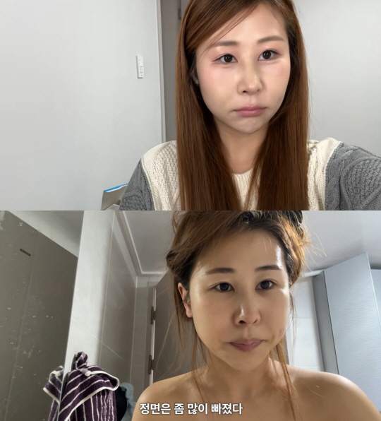 '서준맘' 박세미, 코 재수술 후회하나.."웃을 때 마녀, 옛날 얼굴이 …