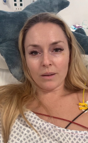 '다리 절단이라니!' 복합 골절, '올림픽 여제' 린지 본 