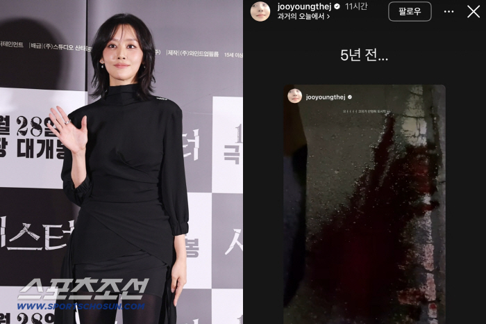 "한 시간 동안 피가 안 멈춰"…'활동 중단' 차주영, 심각했던 출혈 증세[SC이슈]