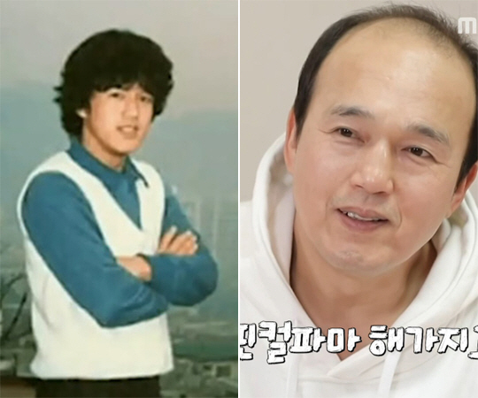 김광규, 조기 탈모 이유 밝혔다...