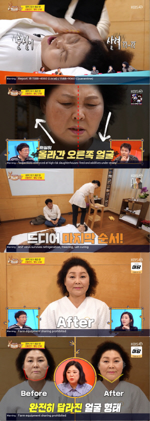 이순실, 100억 벌더니 30kg 감량..한쪽 얼굴 ‘확’ 올라간 충격 변화