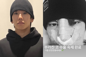 얼굴에 붕대 칭칭 육준서, 코수술 받았다 