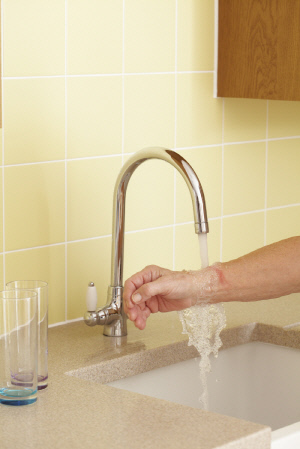 [설 연휴 응급대처-화상] 찬물로 충분히 식히고 소주 붓거나 된장 바르기 금지