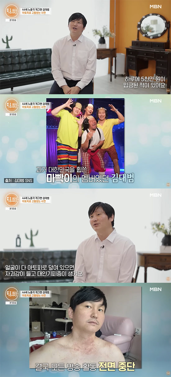 5천만원 스타의 추락…김대범, 전재산 날리고 아토피·공황 "어둠이 무서웠다"