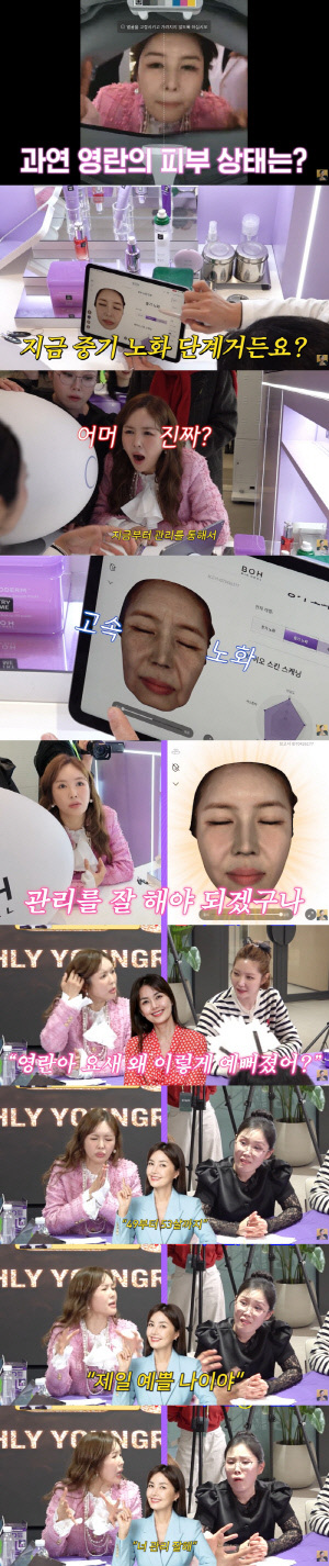 '49세' 장영란, 21kg 감량 후 노화 얻었다...