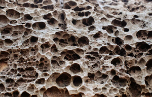 나트륨 넘치고, 칼슘은 부족…'소리 없는 뼈 도둑' 주의