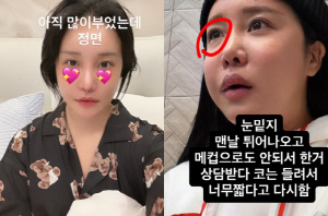 '73kg' 랄랄, 눈밑·코 성형 6일차..'확 달라진 얼굴' 인상까지 변했다
