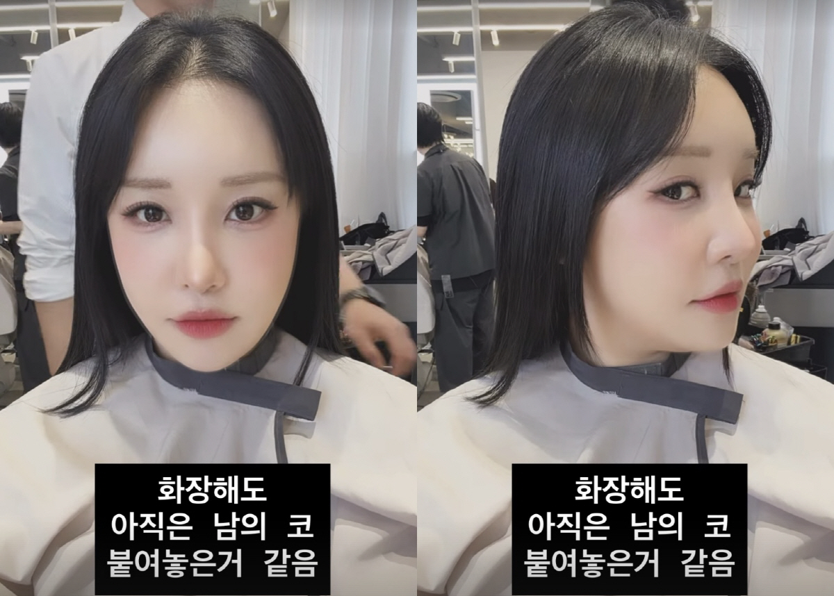 랄랄, '코 재수술' 부기 빠졌는데도 어색 "남의 코 붙인 느낌"