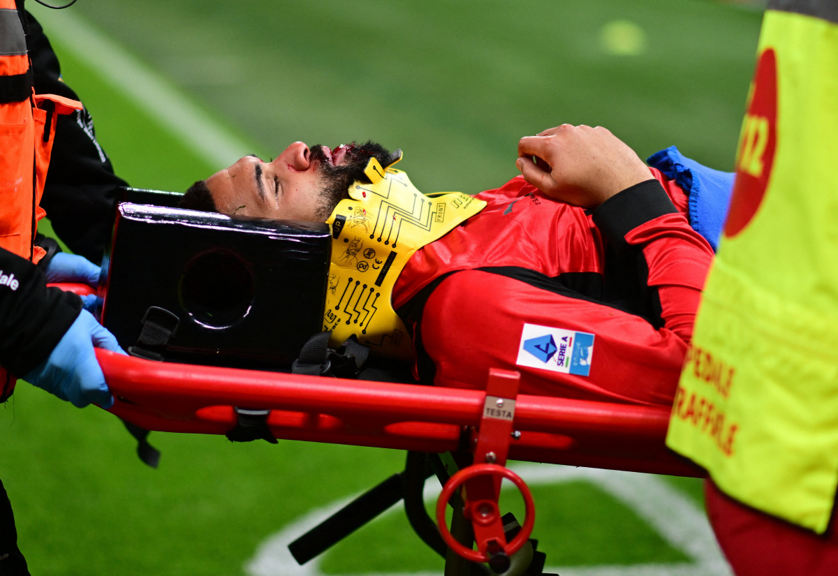 "최악의 상황 지나갔다" 침묵 깬 '피 철철' 잉글랜드 국대, 턱뼈 골절…