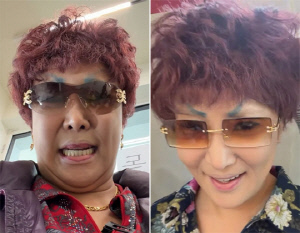 랄랄, 성형 후 확 달라진 얼굴에 혼란...