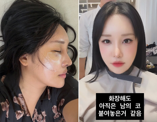 랄랄, 성형 후 확 달라진 얼굴에 혼란..."이명화가 너무 젊어져"