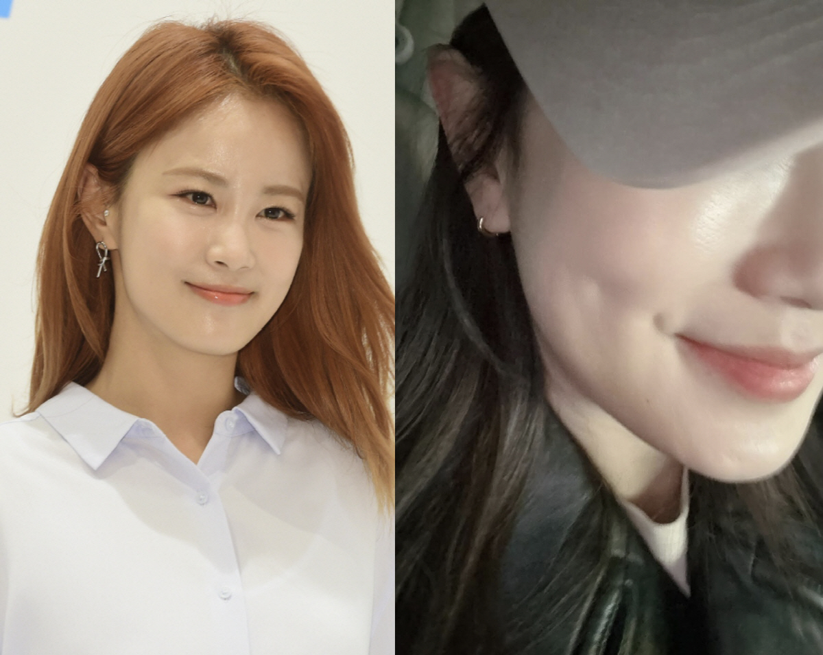 '김준호♥' 김지민, 아찔했던 '욕실 낙상 사고' 극복 중..."보조개인…